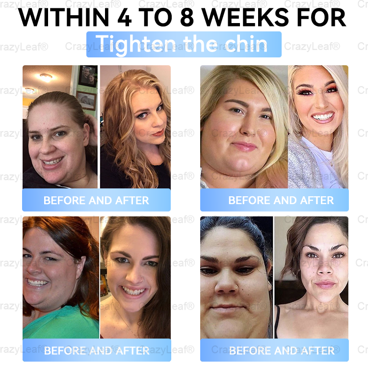 🎯 FDA Registered | Up to 80% OFF | BuildLeaf® GLP-1 Slimming Patch with Collagen + Matrixyl 3000