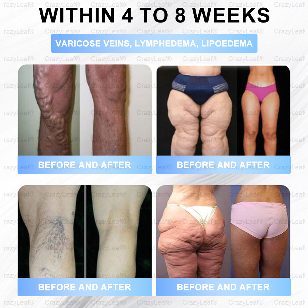 🎯 FDA Registered | Up to 80% OFF | BuildLeaf® GLP-1 Slimming Patch with Collagen + Matrixyl 3000
