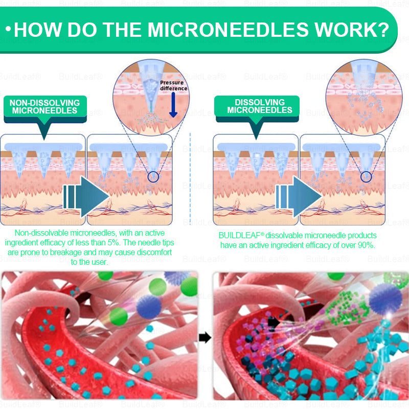 Official Store🏥BuildLeaf® GLP-1 Nano-Microneedle Patch with Collagen & Matrixyl 3000 丨Obesity,Cardiovascular Diseas, Diabetes, Sleep Apnea, Joint Problems and More