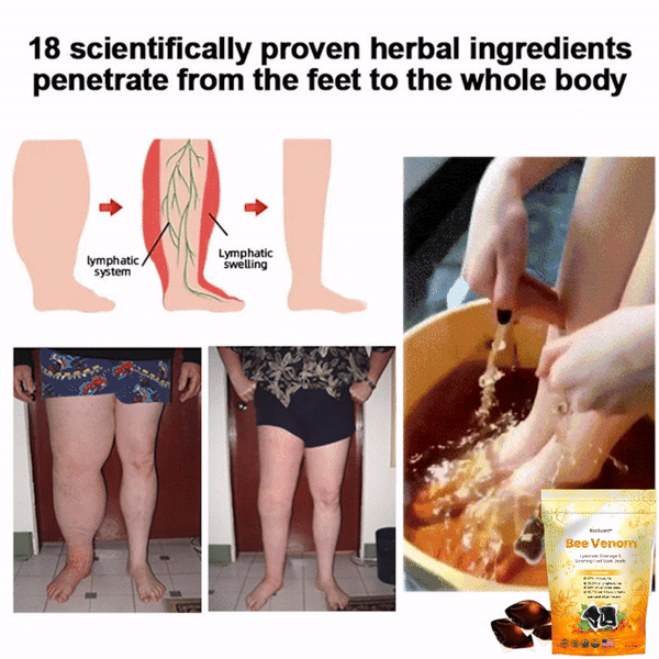 BeeGuard™🌿🌿 Bee Venom Lymphatic Drainage & Slimming Foot Soak Beads 70% Off 【Doctor Recommended - For All Lymphatic Problems and Obesity】