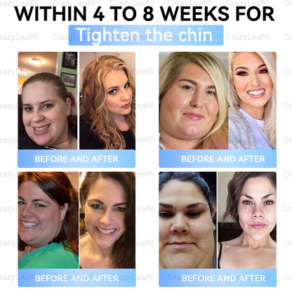 🎯 FDA Registered | Up to 80% OFF | BuildLeaf® GLP-1 Slimming Patch with Collagen + Matrixyl 3000