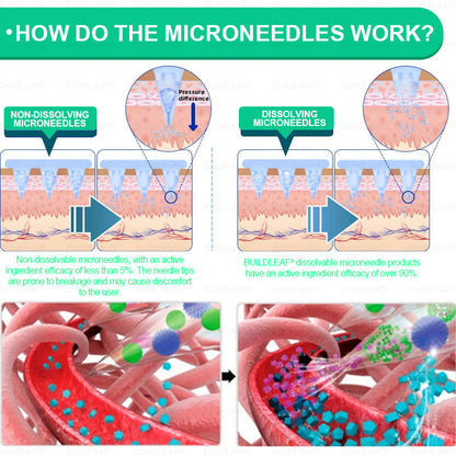 🏥Official Store | BuildLeaf® GLP-1 Nano-Microneedle Patch with Collagen & Matrixyl 3000 丨Obesity,Cardiovascular Diseas, Diabetes, Sleep Apnea, Joint Problems and More